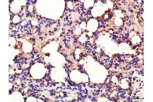 Immunohistochemistry (Paraffin-embedded Sections) (IHC (p)) image for anti-Calpain 1 (CAPN1) (AA 625-713) antibody (ABIN737646)