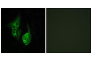 Immunofluorescence analysis of HeLa cells, using OPN5 antibody.