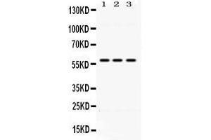Western blot analysis of ALDH7A1 expression in rat liver extract ( Lane 1), HEPA whole cell lysates ( Lane 2) and HELA whole cell lysates ( Lane 3). (ALDH7A1 Antikörper  (C-Term))