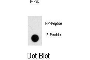Dot blot analysis of anti-Phospho-NOMO1-p Antibody (ABIN389948 and ABIN2839757) on nitrocellulose membrane. (NOMO1 Antikörper  (pSer1205))