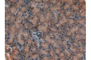 Immunohistochemistry (IHC) image for anti-Heme Oxygenase (Decycling) 1 (HMOX1) (AA 145-237) antibody (ABIN1173249)