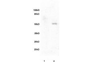 L1 rat brain, L2 human colon carcinoma lysates probed (ABIN728473) at 1:200 in 4 °C. (Fibulin 5 Antikörper  (AA 101-200))