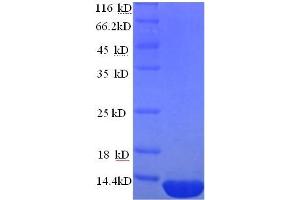 ESAT-6-Like Protein EsxB (AA 2-100) protein (His tag)