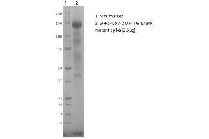 Coomassie-stained reducing SDS-PAGE showing purified SARS-CoV-2 (D614G, E484K Mutant) Spike Glycoprotein (S1).