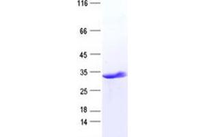 Western Blotting (WB) image for Distal-Less Homeobox Protein 1 (DLX1) protein (His tag) (ABIN2719525)