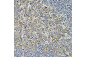 Immunohistochemistry of paraffin-embedded mouse spleen using IRF1 antibody. (IRF1 Antikörper)
