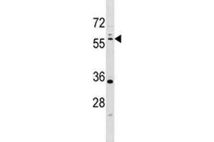 Western Blotting (WB) image for anti-serine/threonine Kinase 11 (STK11) (AA 14-44) antibody (ABIN3032540)