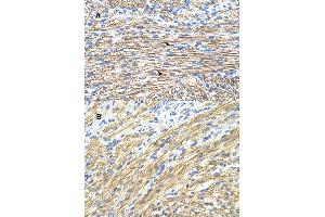 Immunohistochemical staining (Formalin-fixed paraffin-embedded sections) of (A) and (B) human heart with MBNL1 polyclonal antibody . (MBNL1 Antikörper  (AA 211-260))