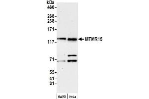 Western Blotting (WB) image for anti-FANCD2/FANCI-Associated Nuclease 1 (FAN1) (AA 1-50) antibody (ABIN7453887)