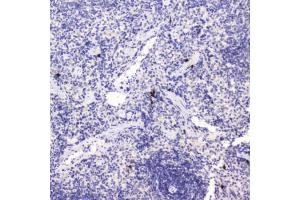 IHC testing of FFPE rat spleen tissue with HE4 antibody at 0. (WFDC2 Antikörper  (AA 31-124))