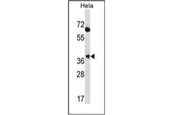 MBNL2 Antikörper  (C-Term)