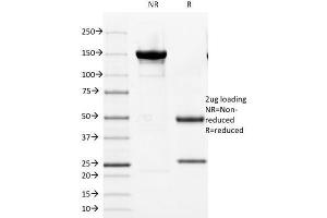 SDS-PAGE Analysis of Purified Cytokeratin 8 Mouse Monoclonal Antibody (KRT8/803). (KRT8, KRT18 Antikörper)