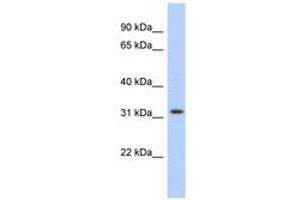 Image no. 1 for anti-Chromosome 1 Open Reading Frame 131 (C1orf131) (AA 107-156) antibody (ABIN6743683)