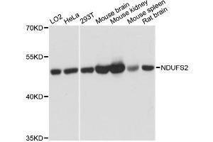 Western blot analysis of extracts of various cell lines, using NDUFS2 antibody. (NDUFS2 Antikörper  (AA 204-463))