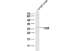 Mouse lymph node lysate probed with CD8a Polyclonal Antibody at 1:300 overnight in 4˚C. (CD8 Antikörper  (AA 101-200))