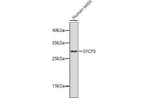 Western blot analysis of extracts of Human testis using SYCP3 Polyclonal Antibody. (SYCP3 Antikörper)