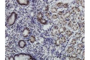 Image no. 1 for anti-Transcriptional Adaptor 2B (TADA2B) (AA 2-111) antibody (ABIN466261) (TADA2B Antikörper  (AA 2-111))