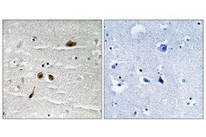 Immunohistochemistry (IHC) image for anti-Mdc1 (MDC1) (pSer513) antibody (ABIN1847790) (MDC1 Antikörper  (pSer513))