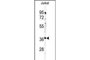 Western blot analysis of anti-PPP6C Antibody in Jurkat cell line lysates (35ug/lane).