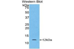 Detection of Recombinant LAMb2, Mouse using Polyclonal Antibody to Laminin Beta 2 (LAMb2) (LAMB2 Antikörper  (AA 1176-1309))