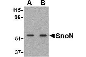 Western Blotting (WB) image for anti-SKI-Like Oncogene (SKIL) (N-Term) antibody (ABIN1031579) (SKIL Antikörper  (N-Term))