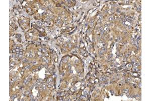 IHC analysis of Pyrin/MEFV using anti-Pyrin/MEFV antibody (ABIN7601809).