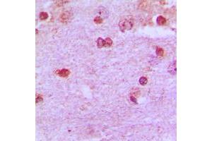 Immunohistochemical analysis of PAX2 staining in human brain formalin fixed paraffin embedded tissue section.