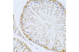 Immunohistochemistry of paraffin-embedded rat testis using PIKFYVE antibody (ABIN5974035) at dilution of 1/100 (40x lens). (PIKFYVE Antikörper)