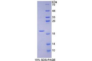 Image no. 1 for Apolipoprotein A-I Binding Protein (APOA1BP) (AA 54-282) protein (His tag) (ABIN4989989)