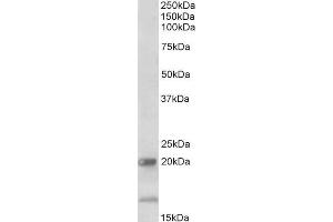 ABIN1590138 (2µg/ml) staining of Human Ileum lysate (35µg protein in RIPA buffer). (IL17B Antikörper  (AA 77-89))