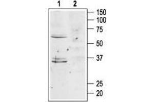 Western blot analysis of mouse brain lysates:1. (Melanocortin 4 Receptor (MC4R) Peptid)