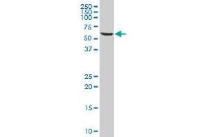 RTN2 polyclonal antibody (A01), Lot # 060525JCS1 Western Blot analysis of RTN2 expression in 293 . (Reticulon 2 Antikörper  (AA 1-100))