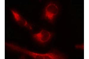 Immunofluorescence staining of methanol-fixed Hela cells using Tau(Phospho-Ser356) Antibody. (MAPT Antikörper  (pSer356))
