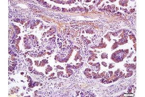 Immunohistochemistry (IHC) image for anti-Wingless-Type MMTV Integration Site Family, Member 8B (WNT8B) (AA 131-230) antibody (ABIN716306)