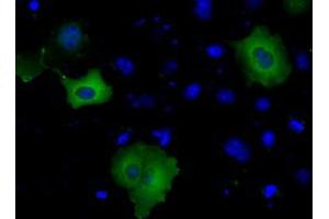 Image no. 5 for anti-Bruton Agammaglobulinemia tyrosine Kinase (BTK) antibody (ABIN1496971) (BTK Antikörper)