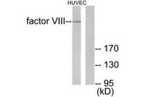 Western blot analysis of extracts from HuvEc cells, using Factor VIII Antibody. (Factor VIII Antikörper  (AA 2161-2210))