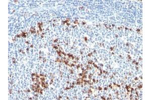 Image no. 2 for Mouse anti-Human kappa Light Chain antibody (ABIN6174183)