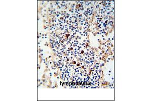 Kappa light chain Antibody (ABIN1539833 and ABIN2843812) immunohistochemistry analysis in formalin fixed and paraffin embedded human lymph tissue followed by peroxidase conjμgation of the secondary antibody and DAB staining. (kappa Light Chain Antikörper)