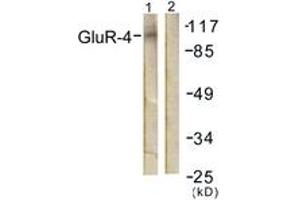 Western blot analysis of extracts from NIH-3T3 cells, treated with Forskolin 40nM 30', using GluR4 (Ab-862) Antibody. (GRIA4 Antikörper  (AA 828-877))