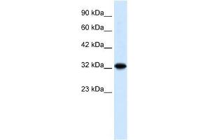 ZBTB32 antibody used at 0. (ZBTB32 Antikörper  (N-Term))
