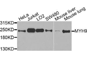 Western blot analysis of extracts of various cells, using MYH9 antibody. (Myosin 9 Antikörper)