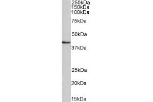 ABIN5539536 (0. (HMBS Antikörper  (AA 160-173))