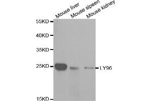Western blot analysis of extracts of various cell lines, using LY96 antibody (ABIN5970959) at 1/1000 dilution. (LY96 Antikörper)
