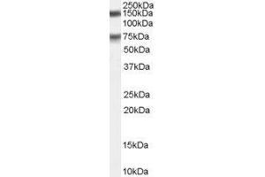 Western Blotting (WB) image for Maternal Embryonic Leucine Zipper Kinase (MELK) peptide (ABIN370227) (Maternal Embryonic Leucine Zipper Kinase (MELK) Peptid)
