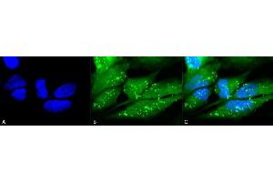 Immunocytochemistry/Immunofluorescence analysis using Rabbit Anti-p38 Polyclonal Antibody (ABIN361847 and ABIN361848). (MAPK14 Antikörper)