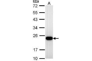 WB Image Transgelin antibody detects TAGLN protein by Western blot analysis. (Transgelin Antikörper)