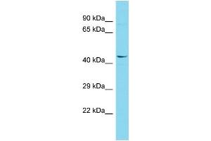 Host: Rabbit Target Name: FAM222A Sample Type: 293T Whole Cell lysates Antibody Dilution: 1. (FAM222A Antikörper  (N-Term))