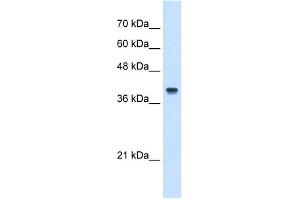 WB Suggested Anti-IFI44L Antibody Titration:  5. (IFI44L Antikörper  (N-Term))