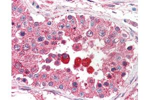 Anti-EIF3M / PCID1 antibody IHC of human testis. (Eukaryotic Translation Initiation Factor 3, Subunit M (EIF3M) (AA 355-366) Antikörper)