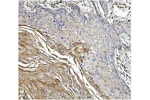 IHC analysis of GSDMD using anti-GSDMD antibody (ABIN7599433). (GSDMD Antikörper  (AA 1-484))